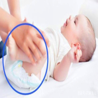 Evite la acción incorrecta de cambiar los pañales del bebé (1)